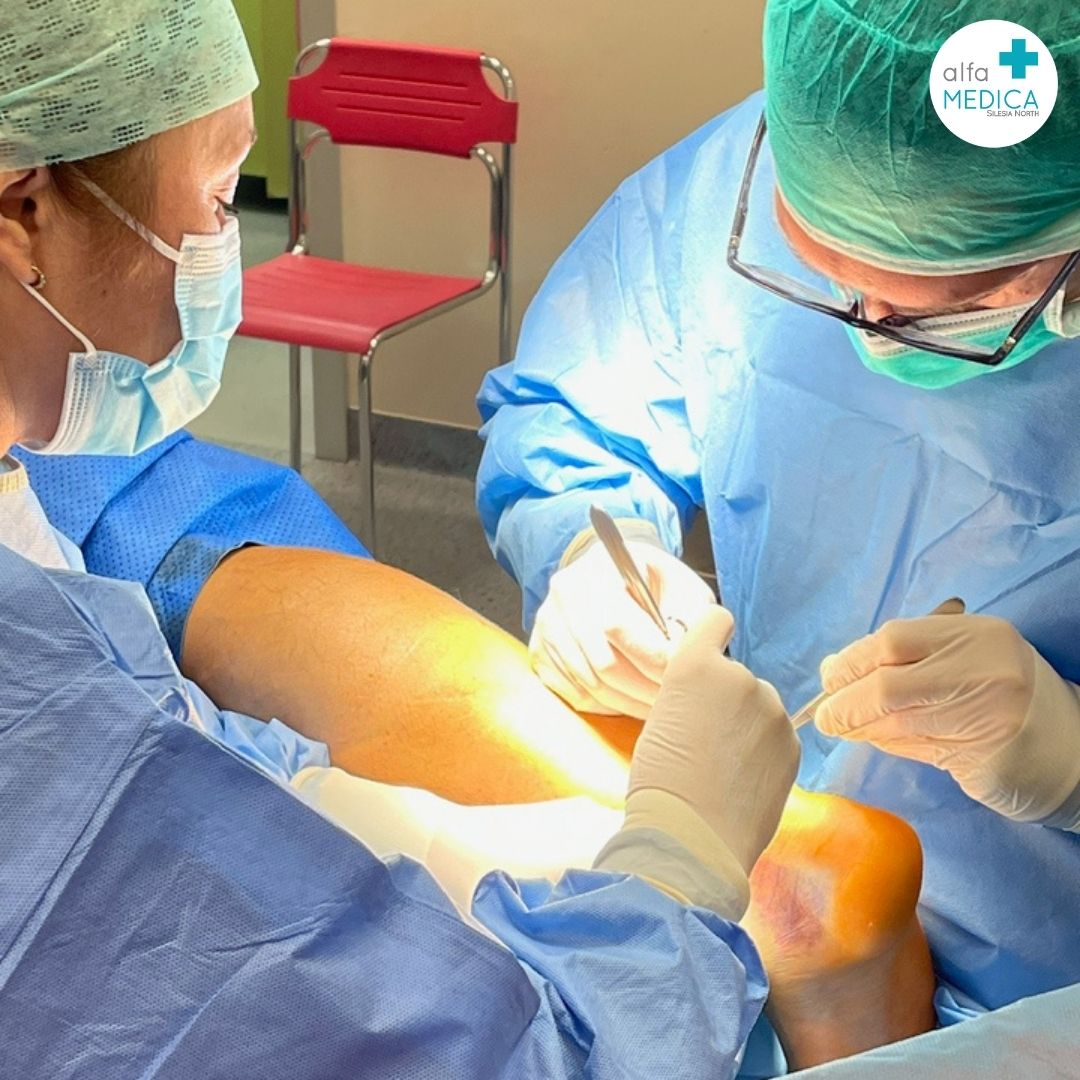 Rekonstrukcja ścięgna Achillesa